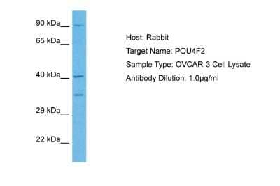 Western Blot: BRN3B/POU4F2 Antibody [NBP2-86585] - Host: Rabbit. Target Name: POU4F2. Sample Tissue: Human OVCAR-3 Whole Cell. Antibody Dilution: 1ug/ml