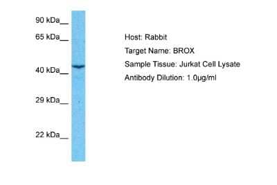 Western Blot: BROX Antibody [NBP2-82791] - Host: Rabbit. Target Name: BROX. Sample Type: Jurkat Whole Cell lysates. Antibody Dilution: 1.0ug/ml