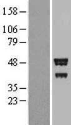 Western Blot: BROX Overexpression Lysate (Adult Normal) [NBP2-05533] Left-Empty vector transfected control cell lysate (HEK293 cell lysate); Right -Over-expression Lysate for BROX.