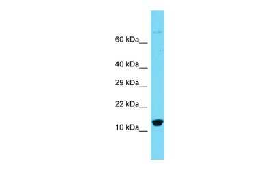 Western Blot: BRP44L Antibody [NBP3-10637] - Western blot analysis of BRP44L in Rat Spleen lysates. Antibody dilution at 1.0ug/ml