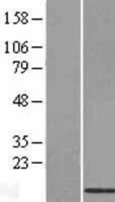 Western Blot: BRP44L Overexpression Lysate (Adult Normal) [NBL1-08030] Left-Empty vector transfected control cell lysate (HEK293 cell lysate); Right -Over-expression Lysate for BRP44L.
