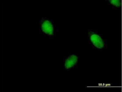 Immunocytochemistry/Immunofluorescence: BRPF1 Antibody [H00007862-B01P] - Analysis of purified antibody to BRPF1 on HeLa cell. (antibody concentration 10 ug/ml)