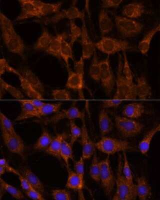 Immunocytochemistry/Immunofluorescence: BRPF1 Antibody [NBP3-15510] - Immunofluorescence analysis of C6 cells using BRPF1 antibody (NBP3-15510) at dilution of 1:100. Blue: DAPI for nuclear staining.