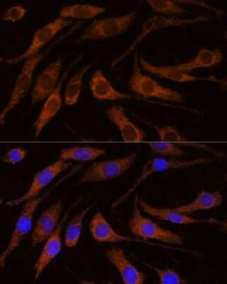 Immunocytochemistry/Immunofluorescence: BRPF1 Antibody [NBP3-15510] - Immunofluorescence analysis of L929 cells using BRPF1 antibody (NBP3-15510) at dilution of 1:100. Blue: DAPI for nuclear staining.