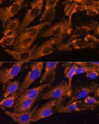 Immunocytochemistry/Immunofluorescence: BRPF1 Antibody [NBP3-15510] - Immunofluorescence analysis of U-2 OS cells using BRPF1 antibody (NBP3-15510) at dilution of 1:100. Blue: DAPI for nuclear staining.