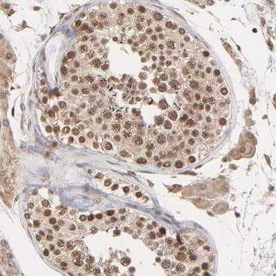 Immunohistochemistry-Paraffin: BRPF1 Antibody [NBP1-88369] - Staining of human testis shows moderate nuclear positivity in cells in seminiferus ducts.