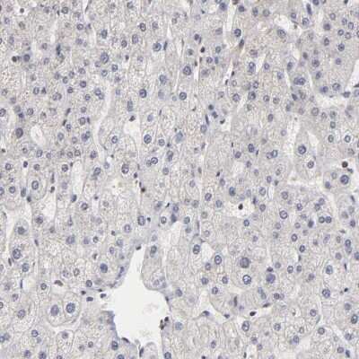 <b>Orthogonal Strategies Validation. </b>Immunohistochemistry-Paraffin: BRPF1 Antibody [NBP1-88369] - Staining of human liver shows low expression as expected.