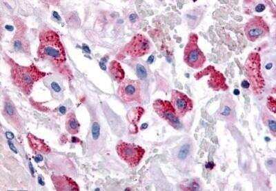 Immunohistochemistry-Paraffin: BRS3 Antibody [NB100-58999] - Analysis of anti-BRS3 antibody with human uterus, pregnant.