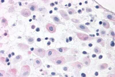 Immunohistochemistry-Paraffin: BRS3 Antibody [NLS4915] - Human pregnant uterus tissue after heat-induced antigen retrieval.