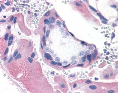 Immunohistochemistry-Paraffin: BRS3 Antibody [NLS5055] - Analysis of anti-BRS3 antibody with human placenta, villi at 7 ug/ml.