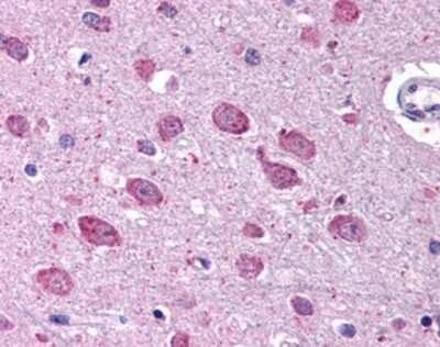 Immunohistochemistry-Paraffin: BRSK1 Antibody [NBP1-03229] - Staining of human brain, cortex. Immunohistochemistry of formalin-fixed, paraffin-embedded tissue after heat-induced antigen retrieval. Antibody concentration 5 ug/ml.