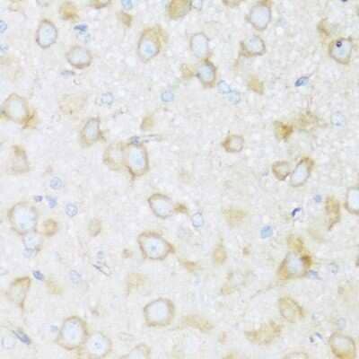 Immunohistochemistry-Paraffin BRSK1 Antibody - Azide and BSA Free