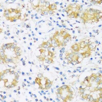 Immunohistochemistry-Paraffin BRSK1 Antibody - Azide and BSA Free