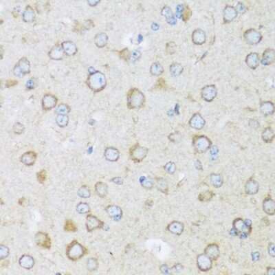 Immunohistochemistry-Paraffin BRSK1 Antibody - Azide and BSA Free