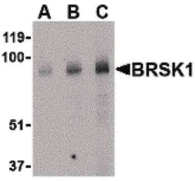 Western Blot: BRSK1 Antibody [NBP1-03229] - Western blot of BRSK1 in human brain tissue lysate with BRSK1 Antibody at (A) 0.5, (B) 1 and (C) 2 ug/ml.