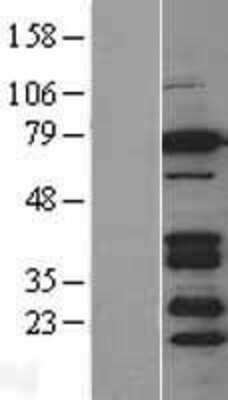 Western Blot: BRSK2 Overexpression Lysate (Adult Normal) [NBL1-08032] Left-Empty vector transfected control cell lysate (HEK293 cell lysate); Right -Over-expression Lysate for BRSK2.