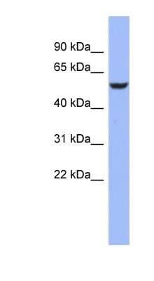 Western Blot: BRUNOL4 Antibody [NBP1-57320] - OVCAR-3 cell lysate, concentration 0.2-1 ug/ml.