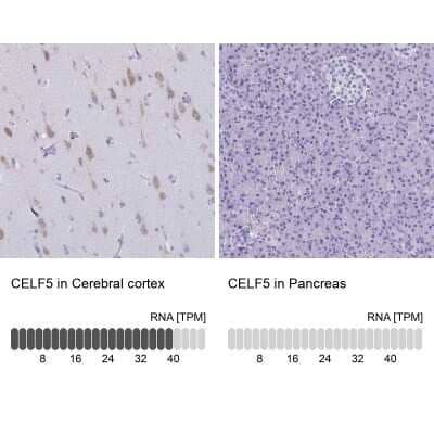 <b>Orthogonal Strategies Validation. </b>Immunohistochemistry-Paraffin: BRUNOL5 Antibody [NBP2-34134] - Staining in human cerebral cortex and pancreas tissues using anti-CELF5 antibody. Corresponding CELF5 RNA-seq data are presented for the same tissues.
