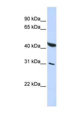 Western Blot: BRUNOL6 Antibody [NBP1-57256] - HepG2 cell lysate, concentration 0.2-1 ug/ml.