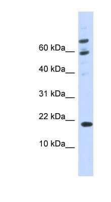 Western Blot: BRWD1-IT2 Antibody [NBP1-91595] - 293T cells lysate, concentration 0.2-1 ug/ml.