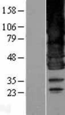 Western Blot: BSCL2 Overexpression Lysate (Adult Normal) [NBL1-08035] Left-Empty vector transfected control cell lysate (HEK293 cell lysate); Right -Over-expression Lysate for BSCL2.