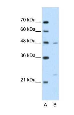 Western Blot: BSDC1 Antibody [NBP1-70421] - Jurkat cell lysate, Antibody Titration: 2.5ug/ml