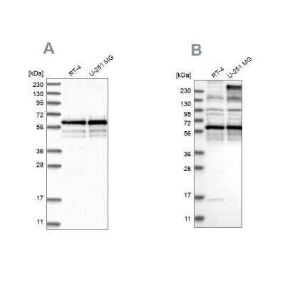 Western Blot: BSDC1 Antibody [NBP1-84644] - Analysis using Anti-BSDC1 antibody NBP1-84644 (A) shows similar pattern to independent antibody NBP2-38180 (B).