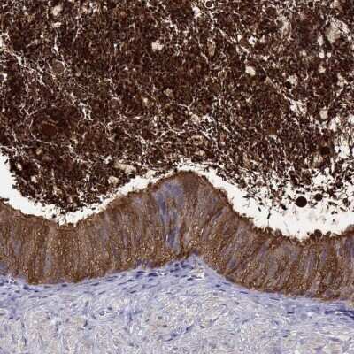 Immunohistochemistry-Paraffin: BSPH1 Antibody [NBP2-62617] - Staining of human epididymis shows high expression.