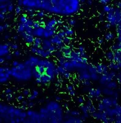 Immunohistochemistry: BST2 Antibody - Azide Free [NBP2-45265] - BST-2 (green) was detected in human skin (nevus) using Ang-2 antibody (1:50; 1 hour) and secondary anti-rabbit-FITC (1:500; 30 min) in PBS. Nuclei were stained with DAPI (blue). Tissue was fixed in acetone. Image from a verified customer review. Image using the standard format of this product.