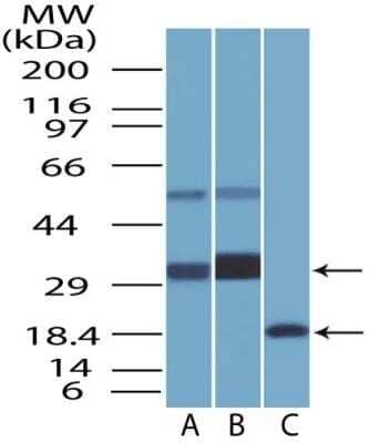 Western Blot: BST2 Antibody (2E2) - Azide and BSA Free [NBP2-80603] - Analysis of BST2 protein in (A) human heart lysate, (B) human ovary lysate and (C) partial recombinant BST2 protein with monoclonal BST2 antibody at a concentration of 1 ug/ml. In the tested human lysates, two distinct bands were observed which represents the glycosylated (lower bands) and the ubiquitinated (higher bands ) forms of BST2 protein. Image from the standard format of this antibody.
