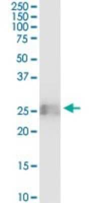 Western Blot: BST2 Antibody (2E6) [H00000684-M15] - Analysis of BST2 expression in human placenta.