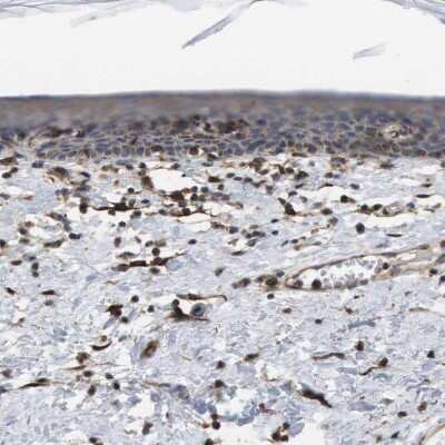 Immunohistochemistry-Paraffin: BST2 Antibody [NBP1-85760] - Staining of human skin shows weak cytoplasmic positivity in epidermal cells.