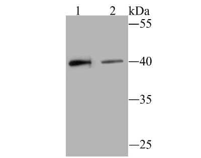 Western Blot: BST2 Antibody (JU11-93) [NBP2-75423] - Analysis of BST2 on Hela (1) and SiHa (2) cell lysate using anti-BST2 antibody at 1/500 dilution.