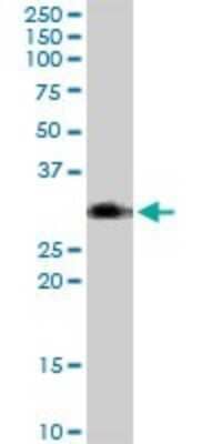 Western Blot: BST2 Antibody [H00000684-B02P] - Analysis of BST2 expression in Jurkat.