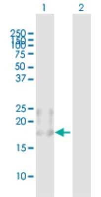 Western Blot: BST2 Antibody [H00000684-B02P] - Analysis of BST2 expression in transfected 293T cell line by BST2 polyclonal antibody.  Lane 1: BST2 transfected lysate(19.8 KDa). Lane 2: Non-transfected lysate.