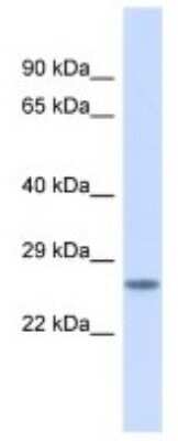 Western Blot: BSX Antibody [NBP3-10601] - Western blot analysis of BSX in Placenta lysates. Antibody dilution at 1.0ug/ml