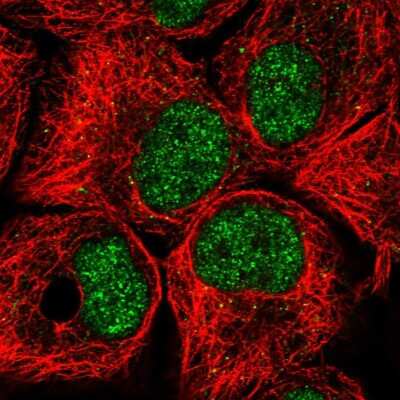 Immunocytochemistry/Immunofluorescence: BTAF1 Antibody [NBP2-57414] - Staining of human cell line HaCaT shows localization to nucleoplasm & vesicles.