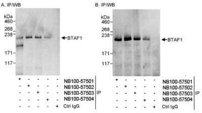 Immunoprecipitation: BTAF1 Antibody [NB100-57502] - Detection of Human BTAF1 by Western Blot of Immunoprecipitates. Samples: Whole cell lysate (1 mg for IP, 20 percent of IP loaded) from HeLa cells. Antibodies: Affinity purified rabbit anti-BTAF1 antibody NB100-57502 used for IP at 3 mcg/mg lysate (A and B). BTAF1 was also immunoprecipitated by rabbit anti-BTAF1 antibodies NB100-57501 and NB100-57503, which recognize other epitopes. Detection: Chemiluminescence with exposure times of 3 seconds (A) and 30 seconds (B).