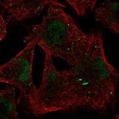 Immunocytochemistry/Immunofluorescence: BTBD1 Antibody [NBP3-17690] - Staining of human cell line RH-30 shows localization to nucleoplasm & cytoplasmic bodies.