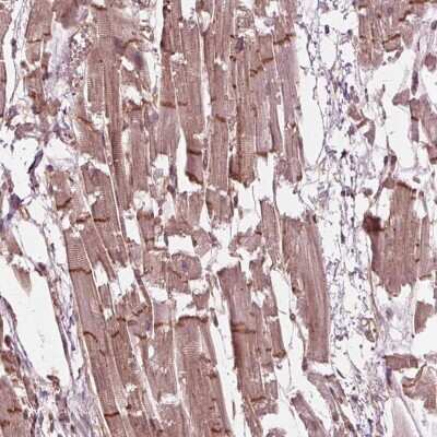 Immunohistochemistry: BTBD1 Antibody [NBP2-38109] - Staining of human heart muscle shows moderate positivity in intercalated discs.