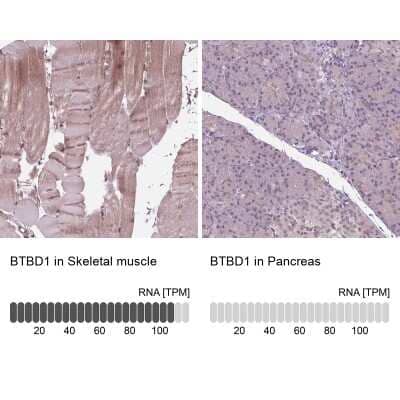 <b>Orthogonal Strategies Validation. </b>Immunohistochemistry-Paraffin: BTBD1 Antibody [NBP2-38109] - Staining in human skeletal muscle and pancreas tissues using anti-BTBD1 antibody. Corresponding BTBD1 RNA-seq data are presented for the same tissues.