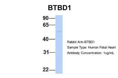 Western Blot: BTBD1 Antibody [NBP2-87087] - Host: Rabbit. Target Name: BTBD1. Sample Type: Human Fetal Heart. Antibody Dilution: 1.0ug/ml