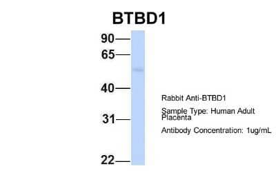 Western Blot: BTBD1 Antibody [NBP2-87087] - Host: Rabbit. Target Name: BTBD1. Sample Type: Human Adult Placenta. Antibody Dilution: 1.0ug/ml