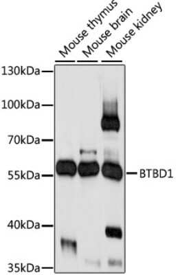 Western Blot: BTBD1 Antibody [NBP2-92210] - Analysis of extracts of various cell lines, using BTBD1 at 1:1000 dilution.Secondary antibody: HRP Goat Anti-Rabbit IgG (H+L) at 1:10000 dilution.Lysates/proteins: 25ug per lane.Blocking buffer: 3% nonfat dry milk in TBST.Detection: ECL Basic Kit .Exposure time: 10s.