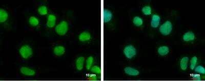Immunocytochemistry/Immunofluorescence: BTBD10 Antibody [NBP2-15625] - NT2D1 cells were fixed in 4% paraformaldehyde at RT for 15 min.Green: BTBD10 protein stained by BTBD10 antibody [N3C3]  diluted at 1:500. Blue: Hoechst 33342 staining.