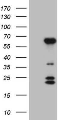 Western Blot: BTBD10 Antibody (OTI7D3) - Azide and BSA Free [NBP2-72293] - Analysis of HEK293T cells were transfected with the pCMV6-ENTRY control (Left lane) or pCMV6-ENTRY BTBD10.
