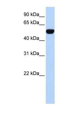 Western Blot: BTBD10 Antibody [NBP1-80088] - 293T cells lysate, concentration 0.2-1 ug/ml.