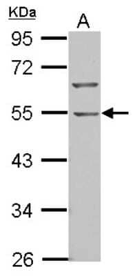 Western Blot: BTBD10 Antibody [NBP2-15625] - Sample (30 ug of whole cell lysate) A: NT2D1 10% SDS PAGE gel, diluted at 1:1000.