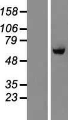 Western Blot: BTBD10 Overexpression Lysate (Adult Normal) [NBL1-08041] Left-Empty vector transfected control cell lysate (HEK293 cell lysate); Right -Over-expression Lysate for BTBD10.