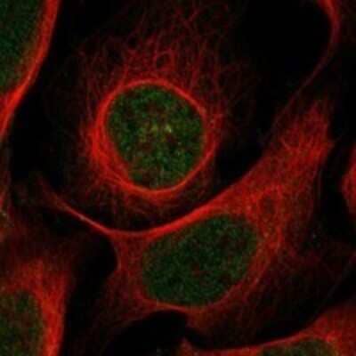 Immunocytochemistry/Immunofluorescence: BTBD11 Antibody [NBP3-17152] - Staining of human cell line U-2 OS shows localization to nucleoplasm.